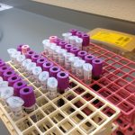 DNA analyse Result Laboratorium