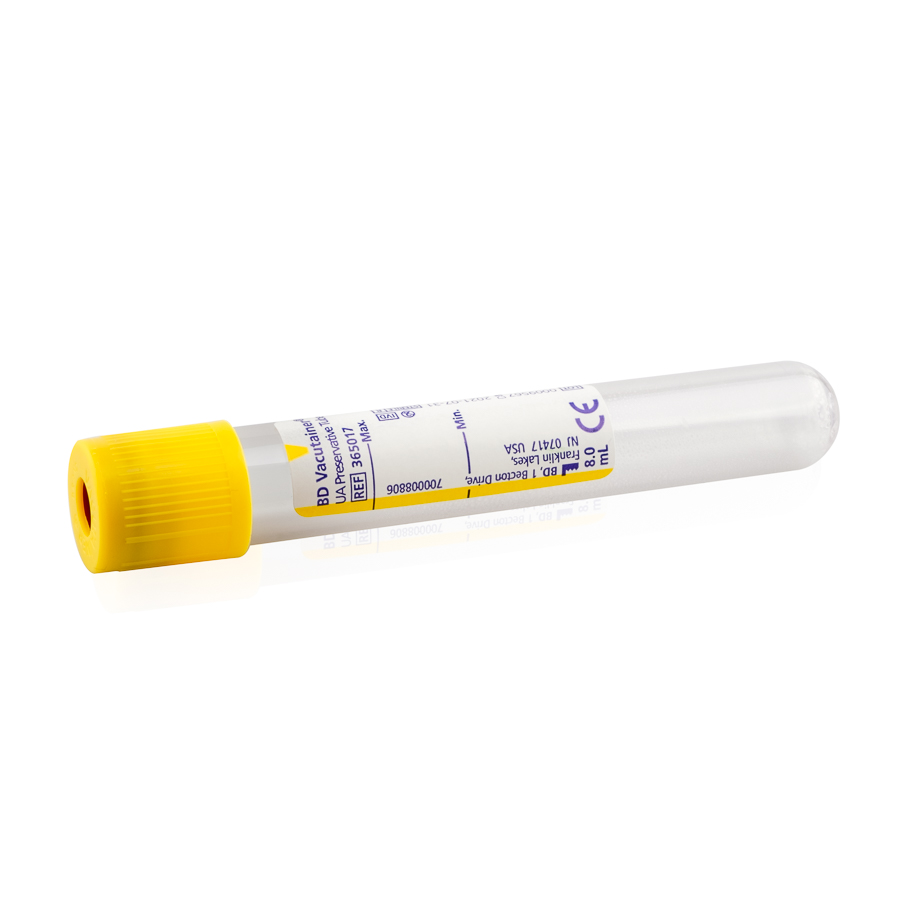 Scherm Familielid Herrie urine buis 8 mL, gele dop - Resultlaboratorium